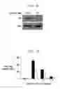 Fig. 11 - Method for Treating Immune Dysfunction by Regulation of CD40 Ligand Expression