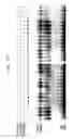 Fig. 15 - Method for Treating Immune Dysfunction by Regulation of CD40 Ligand Expression