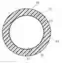Fig. 01 - Medical device for insertion into human body, and method of manufacture