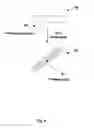 Fig. 09 - Injectable chondrocyte implant