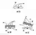 Fig. 02 - Medical device, materials, and methods