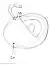 Fig. 01 - Gastro-intestinal device and method for treating addiction