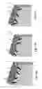 Fig. 11 - ORTHODONTIC BRACKET