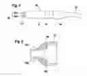 Fig. 03 - Manual dental instrument, dental care unit and method for displaying data using a manual dental instrument