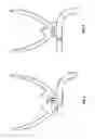 Fig. 03 - ADJUSTABLE DENTAL BITE FORK