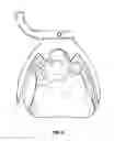 Fig. 04 - ADJUSTABLE DENTAL BITE FORK
