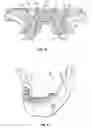 Fig. 04 - Dental patient models