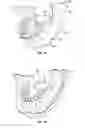 Fig. 12 - Dental patient models