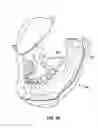 Fig. 13 - Dental patient models