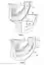 Fig. 14 - Dental patient models