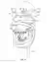 Fig. 20 - Dental patient models