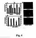 Fig. 05 - Methods of diagnosing atherosclerosis by measuring ApoCI