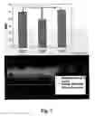 Fig. 08 - Methods of diagnosing atherosclerosis by measuring ApoCI