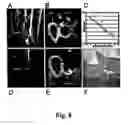 Fig. 09 - Methods of diagnosing atherosclerosis by measuring ApoCI
