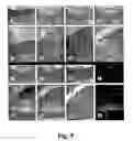 Fig. 10 - Methods of diagnosing atherosclerosis by measuring ApoCI