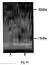 Fig. 11 - Methods of diagnosing atherosclerosis by measuring ApoCI