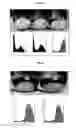 Fig. 11 - High efficiency gene transfer and expression in mammalian cells by a multiple transfection procedure of MAR sequences