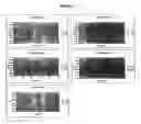 Fig. 304 - Nucleic acid detection assays