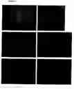 Fig. 06 - Methods and compositions for identifying bacteria associated with bacteria vaginosis