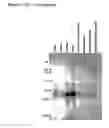 Fig. 16 - ME-5, ME-2, and EPP2: human protein antigens reactive with autoantibodies present in the serum of women suffering from endometriosis