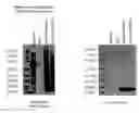 Fig. 20 - ME-5, ME-2, and EPP2: human protein antigens reactive with autoantibodies present in the serum of women suffering from endometriosis