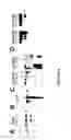 Fig. 05 - Goodpasture antigen binding protein