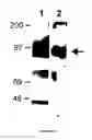 Fig. 07 - Goodpasture antigen binding protein