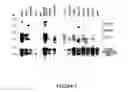 Fig. 10 - Goodpasture antigen binding protein