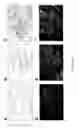 Fig. 14 - Goodpasture antigen binding protein