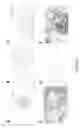 Fig. 15 - Goodpasture antigen binding protein