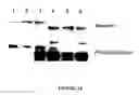 Fig. 19 - Goodpasture antigen binding protein
