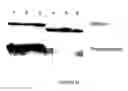 Fig. 20 - Goodpasture antigen binding protein