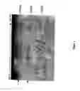 Fig. 06 - Method of isolating a protein