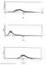 Fig. 02 - Novel N-acetylglucosaminyltransferase, nucleic acid coding for the same, and uses thereof for diagnosis of cancer or tumor