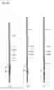 Fig. 22 - Chromatography kit, examination container, and method for manufacturing the same