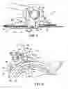 Fig. 06 - Bicycle front derailleur