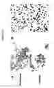 Fig. 11 - Modulation of MDL-1 activity for treatment of inflammatory disease