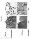 Fig. 23 - Modulation of MDL-1 activity for treatment of inflammatory disease