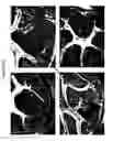 Fig. 36 - Modulation of MDL-1 activity for treatment of inflammatory disease