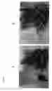 Fig. 06 - Methods and compositions for slowing aging