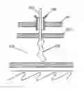 Fig. 01 - METHODS AND DEVICES FOR PERCUTANEOUSLY MODIFYING ORGANS TO TREAT PATIENTS
