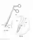 Fig. 10 - METHODS AND DEVICES FOR PERCUTANEOUSLY MODIFYING ORGANS TO TREAT PATIENTS