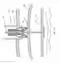 Fig. 16 - METHODS AND DEVICES FOR PERCUTANEOUSLY MODIFYING ORGANS TO TREAT PATIENTS