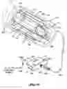 Fig. 02 - Penile illuminating and extending equipment & method
