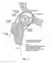 Fig. 02 - Method and devices for minimally invasive arthroscopic procedures