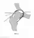 Fig. 04 - Method and devices for minimally invasive arthroscopic procedures