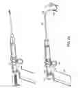 Fig. 06 - Method and devices for minimally invasive arthroscopic procedures