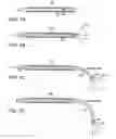 Fig. 09 - Method and devices for minimally invasive arthroscopic procedures