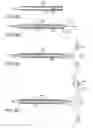 Fig. 10 - Method and devices for minimally invasive arthroscopic procedures