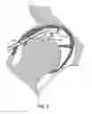 Fig. 11 - Method and devices for minimally invasive arthroscopic procedures